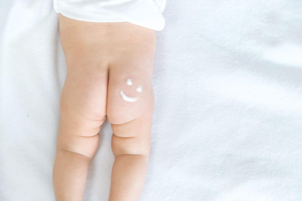 รับผลิต ครีมทาแก้ผื่นผ้าอ้อม (Diaper Rash Cream) กับโรงงาน Natureprof