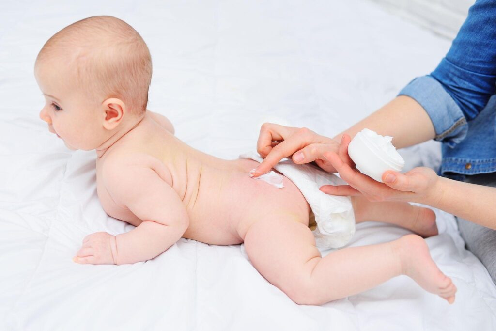 รับผลิต ครีมทาแก้ผื่นผ้าอ้อม (Diaper Rash Cream) กับโรงงาน Natureprof